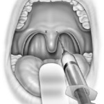 Friedman Surgical Atlas Figures. (Artist: James Millerick)